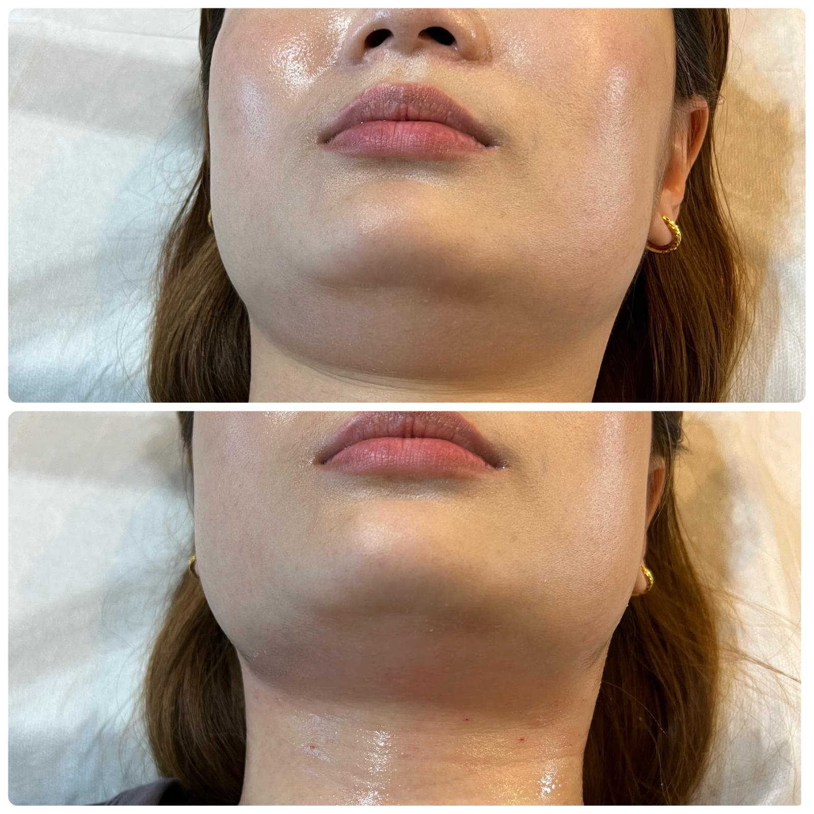 Targeted contouring client result reference 5